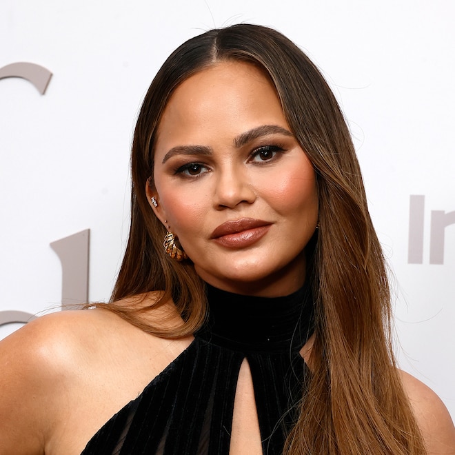 E! Online (US) – Top Stories: Chrissy Teigen Reveals Photo From Hairline Lowering Procedure